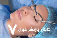 ۱۰ سوال مهم که باید پیش از جراحی پلک از پزشک خود بپرسید ۱۰ سوال مهم که باید پیش از جراحی پلک از پزشک خود بپرسید