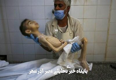 آمار هولناک از مرگ بر اثر گرسنگی در غزه آمار هولناک از مرگ بر اثر گرسنگی در غزه