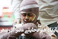 با سوختگی ناشی از حملات جنگی چه کنیم؟ با سوختگی ناشی از حملات جنگی چه کنیم؟