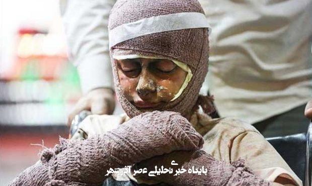 با سوختگی ناشی از حملات جنگی چه کنیم؟ با سوختگی ناشی از حملات جنگی چه کنیم؟