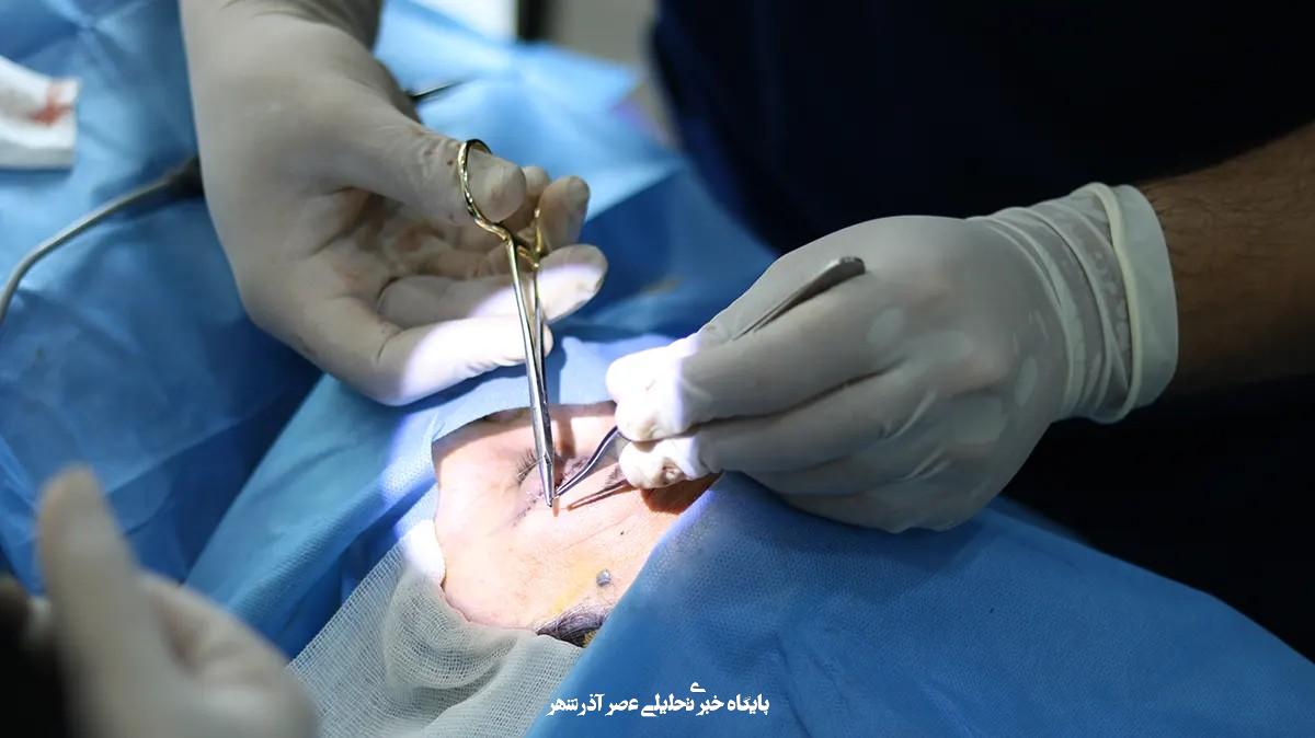 قیمت عمل بلفاروپلاستی