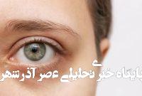 آیا واقعاً شببیداری باعث ایجاد حلقههای تیره زیر چشم میشود؟ آیا واقعاً شببیداری باعث ایجاد حلقههای تیره زیر چشم میشود؟