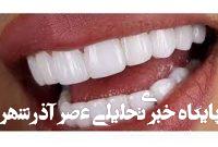 انواع کامپوزیت دندان، مزایا و معایب آن را بشناسید