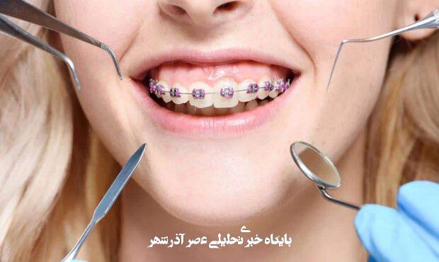 همه چیز درباره هزینه ارتودنسی دندان در سال ۱۴۰۴ + نکات مهم قبل از شروع درمان همه چیز درباره هزینه ارتودنسی دندان در سال ۱۴۰۴ + نکات مهم قبل از شروع درمان