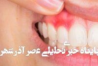 عفونت دندان و مشکلات آن: هر آنچه باید بدانید